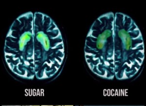 this-is-your-brain-on-sugar-vs-cocaine